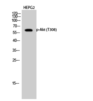 Akt (phospho Thr308) Polyclonal Antibody