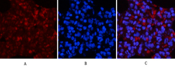 NFκB-p65 (phospho Ser536) Polyclonal Antibody