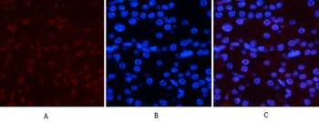 NFκB-p65 (phospho Ser536) Polyclonal Antibody