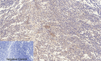 ERK 1/2 (phospho Thr202) Polyclonal Antibody
