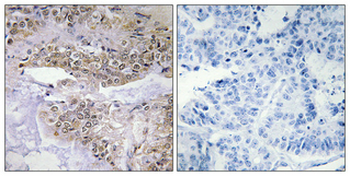 Cofilin (phospho Ser3) Polyclonal Antibody