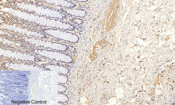 Akt (phospho Ser473) Polyclonal Antibody