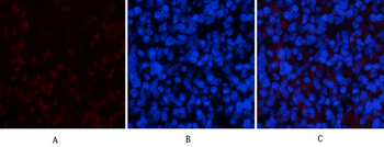 ERK1 mouse Monoclonal Antibody(5E9)