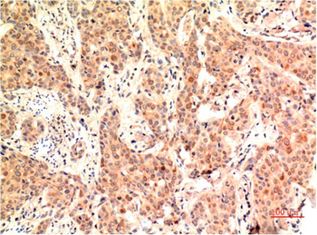 ERK1 mouse Monoclonal Antibody(5E9)