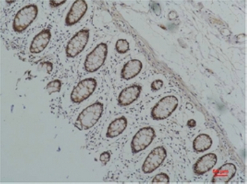 HSP90 α Monoclonal Antibody(7D6)