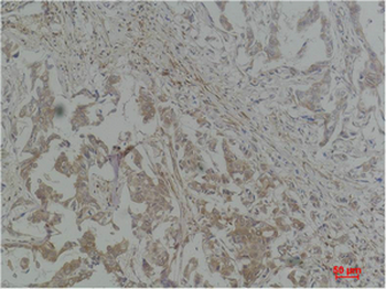 Stat1 Polyclonal Antibody
