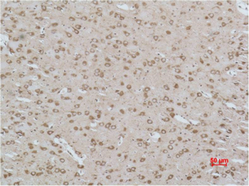 CACNG3 Polyclonal Antibody