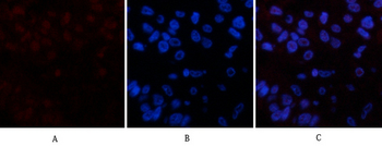Cleaved PARP Monoclonal Antibody(Mix)
