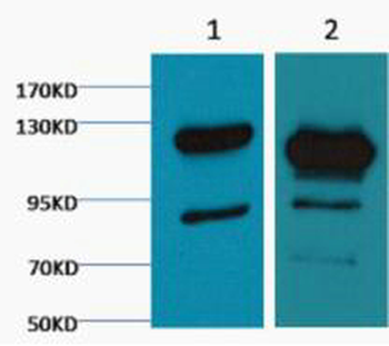 Cleaved PARP Monoclonal Antibody(M4)