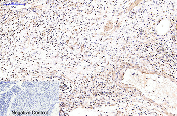 NFkB p65 Monoclonal Antibody(5G6)