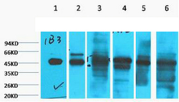 Cytokeratin 18 Monoclonal Antibody(1B3)