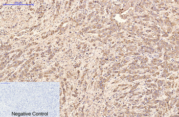 AFP alpha 1 Fetoprotein Monoclonal Antibody(17C5)