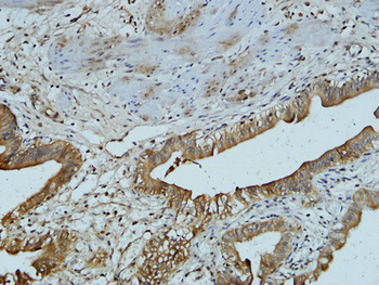 AFP alpha 1 Fetoprotein Monoclonal Antibody(17C5)
