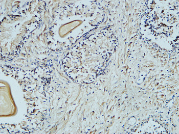 AFP alpha 1 Fetoprotein Monoclonal Antibody(17C5)