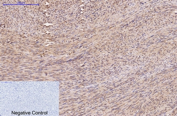FH Monoclonal Antibody(7F1)