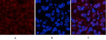 p53 (Di Methyl Lys370) Polyclonal Antibody