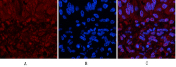 p53 (Di Methyl Lys370) Polyclonal Antibody