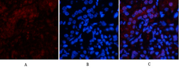 p53 (Di Methyl Lys370) Polyclonal Antibody