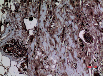 Histone H3 (Mono Methyl Lys5) Polyclonal Antibody