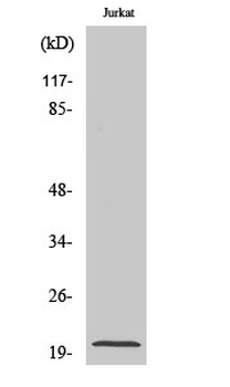 Cleaved-Caspase-7 p20 (D198) Polyclonal Antibody