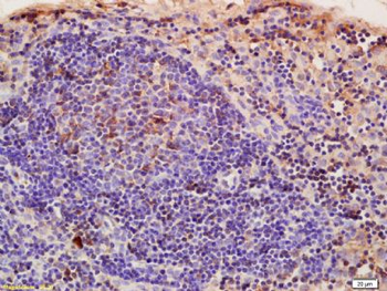 CRIM1 Polyclonal Antibody