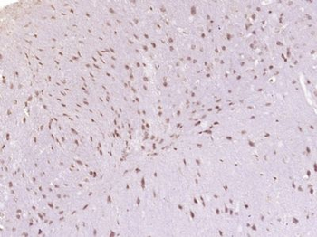 Prickle 2 Polyclonal Antibody