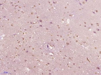 NCKIPSD Polyclonal Antibody