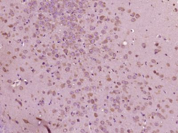 HPCAL4 Polyclonal Antibody