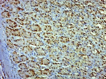ZSWIM4 Polyclonal Antibody