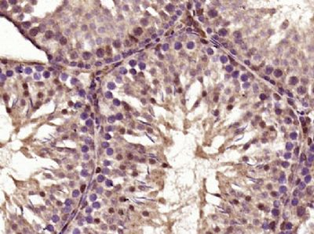 C5orf24 Polyclonal Antibody