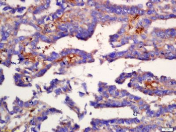 COX6B2 Polyclonal Antibody