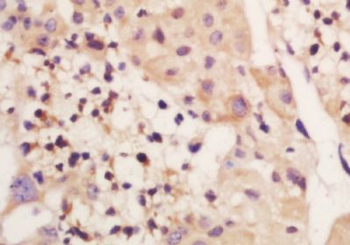 Genethonin 1 Polyclonal Antibody