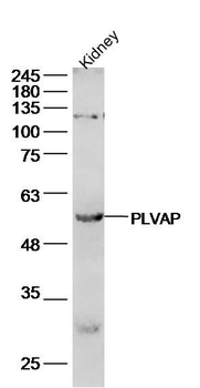 PLVAP Polyclonal Antibody