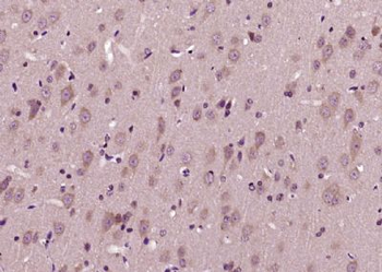 PLVAP Polyclonal Antibody