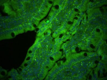 PLVAP Polyclonal Antibody