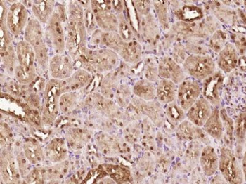 ATBF1 Polyclonal Antibody