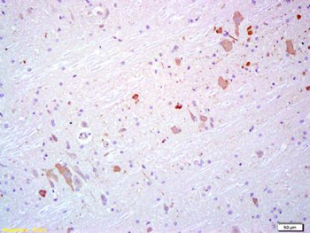 HECW1 Polyclonal Antibody