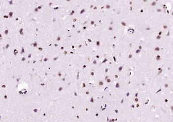 BPTF Polyclonal Antibody