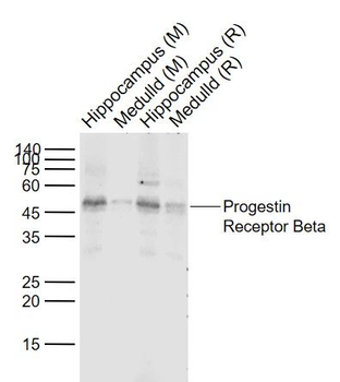 Progestin Receptor Beta Polyclonal Antibody