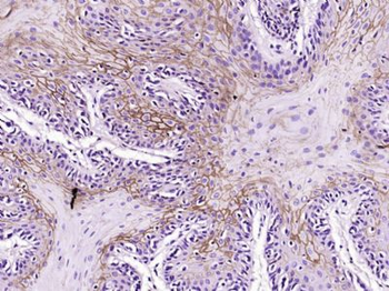 Progestin Receptor Beta Polyclonal Antibody