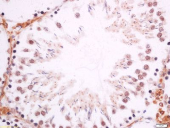 Dmrta1 Polyclonal Antibody