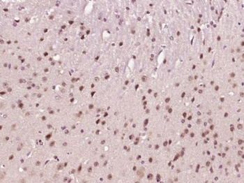 NR5A2 Polyclonal Antibody