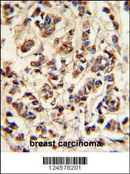 ATP6V1A Antibody (Center)