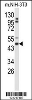 GORAB Antibody (N-term)