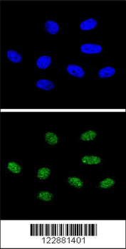 PIN1 Antibody (Center)