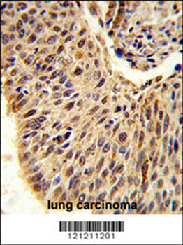 GLIS1 Antibody (N-term)