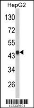 VPS26A Antibody (Center)