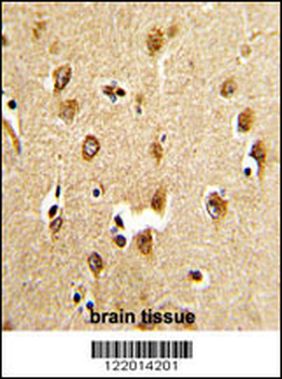 ABI1 Antibody (N-term)