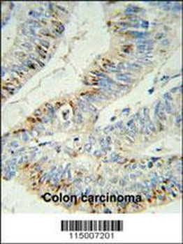 PHLPP2 Antibody (C-term)