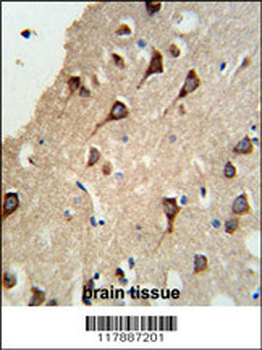 FYN Antibody (N-term)
